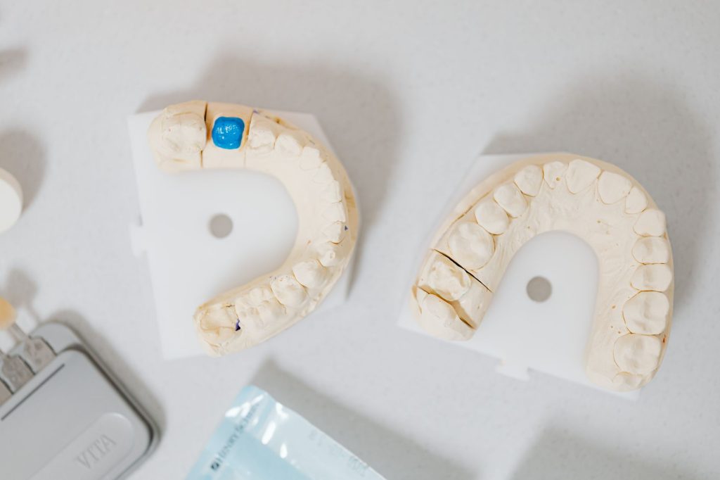 5 Dental Crown Benefits Most People Overlook